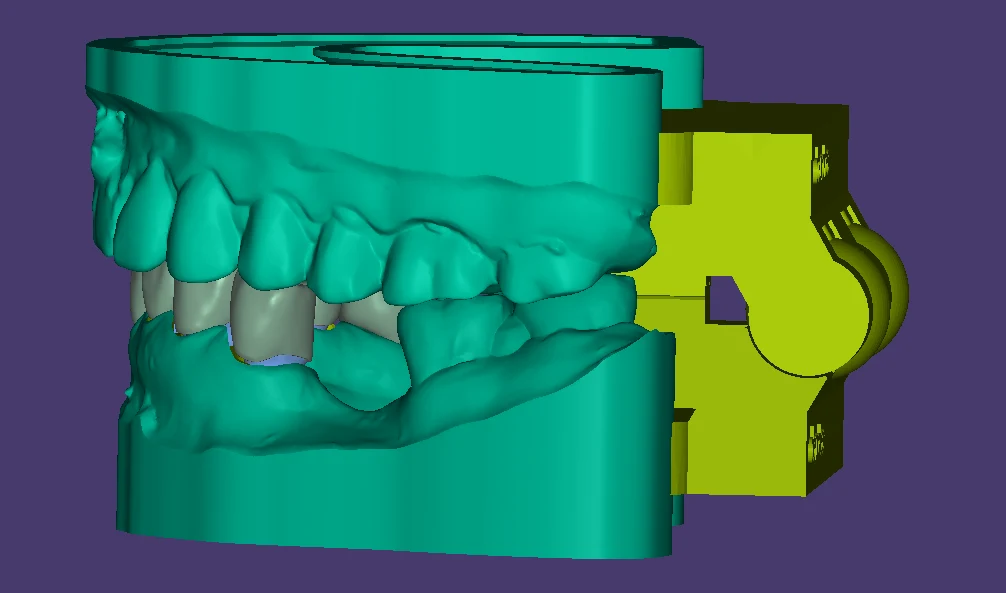 Digital dental model preparation in CAD software